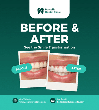 Green and White Modern Dental Transformation Instagram Post
